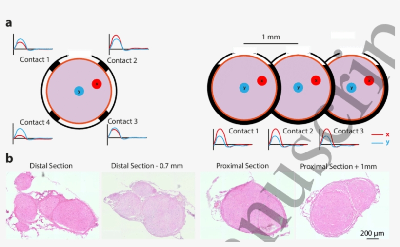 A) Schematic Representation Of The Sciatic Nerve With, transparent png