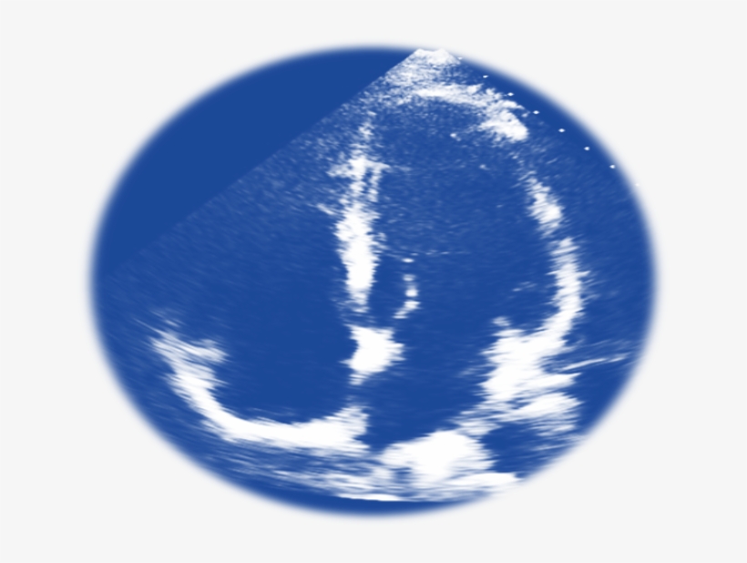 A4c-blue, transparent png