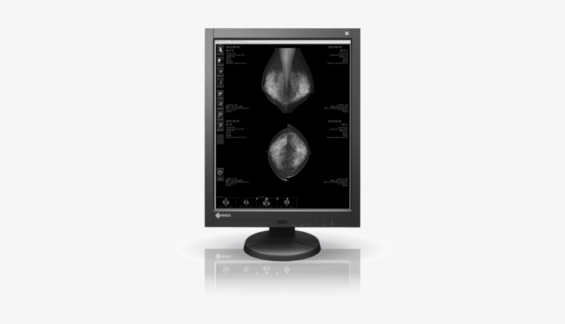 Changing The Mammographic Imaging Paradigm - Eizo Radiforce G5310, transparent png