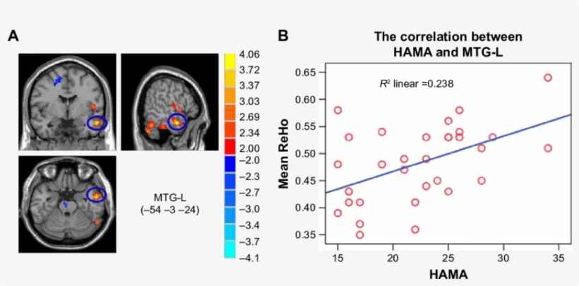 Correlation Between Mtg L And Hama Scores, transparent png