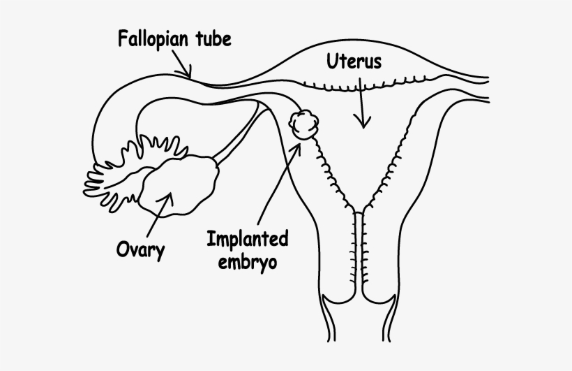 Embryo Implantation, transparent png