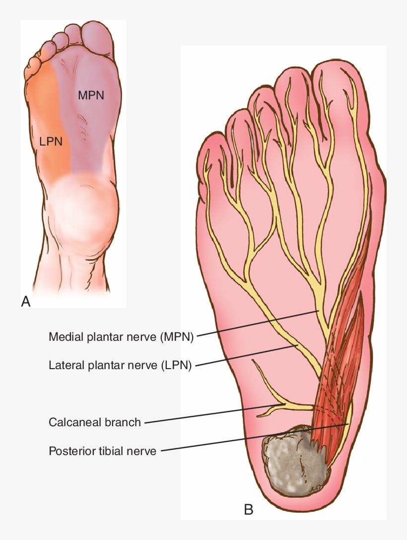 Compression Of Either The Posterior Tibial Nerve At, transparent png