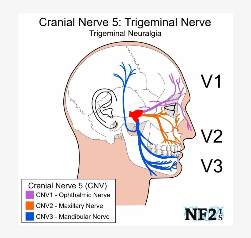 Cranial Nerve 5, Subparts, 3 Branches, Branches, Filiment,, transparent png