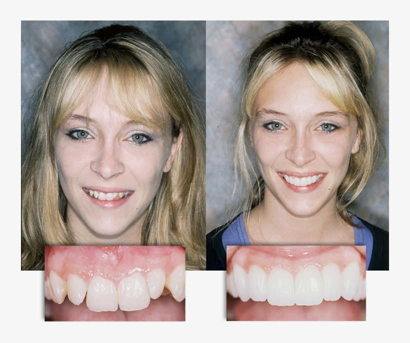 Dramatic Before And After Transformation At Integrative, transparent png