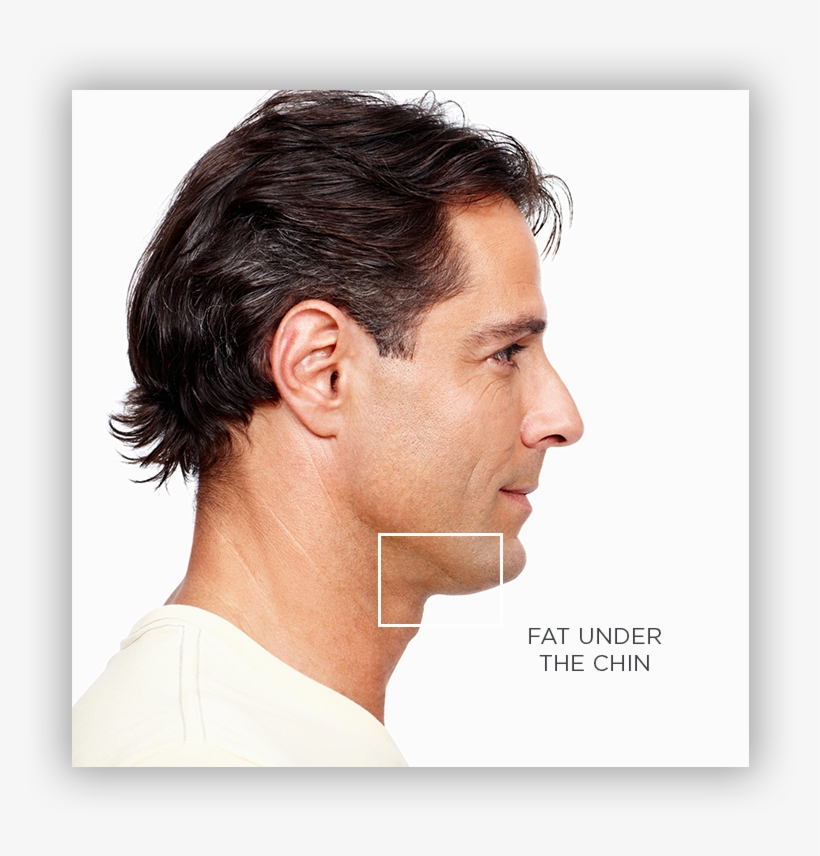 We Can Treat The Following Conditions That Result In, transparent png