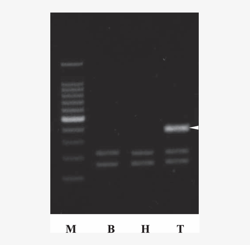 Restriction Pattern Of Haeiii Digested Ribosomal Rna, transparent png