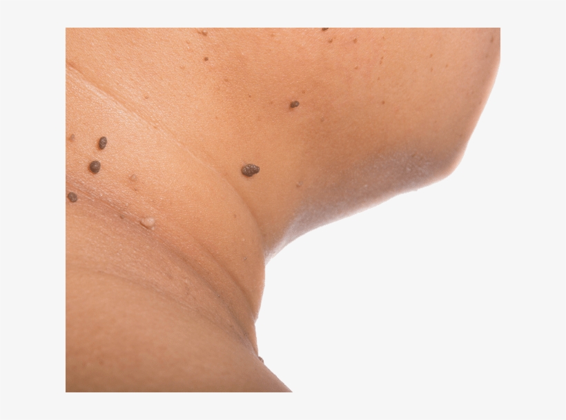 Mole, transparent png