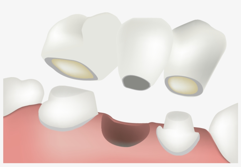 Porcelain Bridges, transparent png