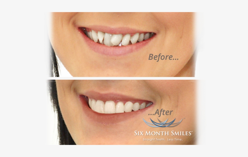 Slide-six Month Smile - Lip Gloss, transparent png