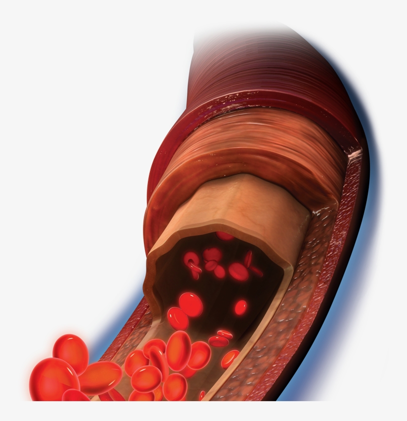 Tissue And Circulation - Medical Equipment, transparent png