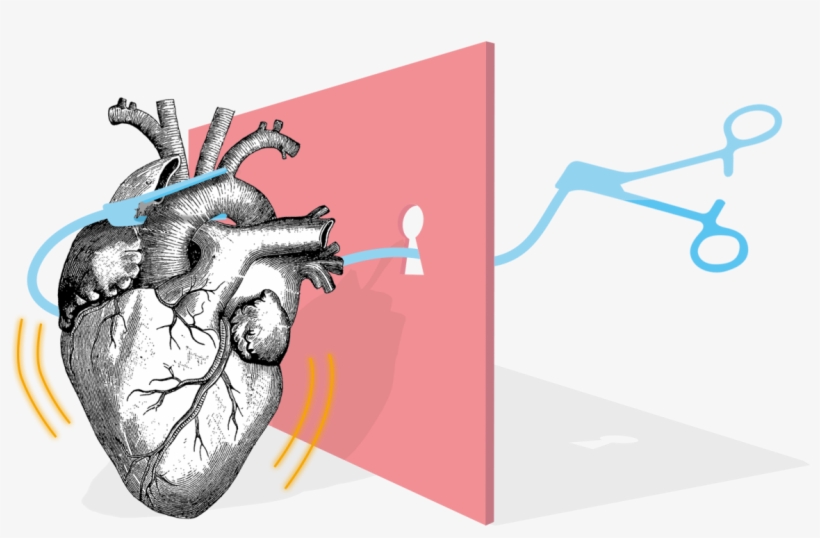 Heart Surgery - Anatomical Heart, transparent png