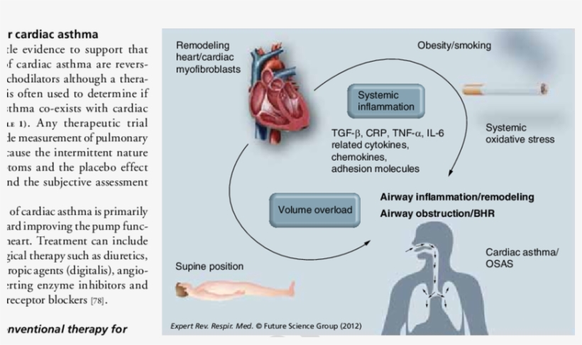 Components Of Airway Obstruction In Congestive Heart - Smoking Congestive Heart Failure, transparent png