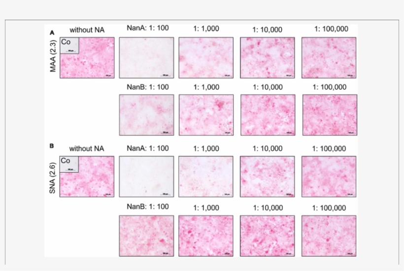 Influence Of Recombinant Nana And Nanb On Expression - Style, transparent png
