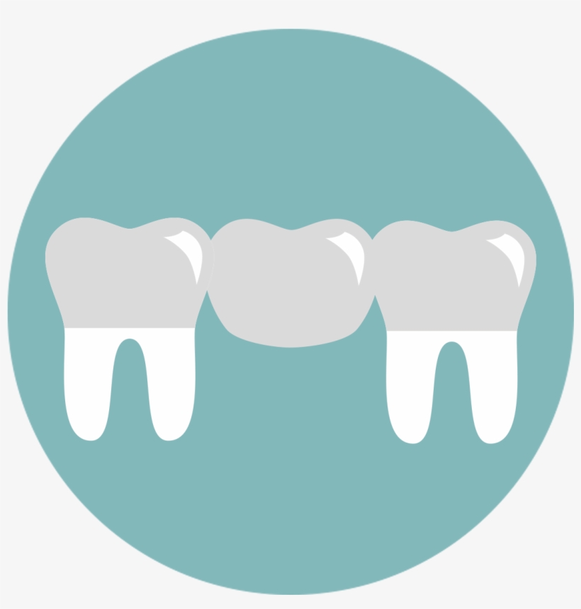 A Bridge Is One Method To Replace Missing Teeth, And - Bridge Tooth Icon, transparent png