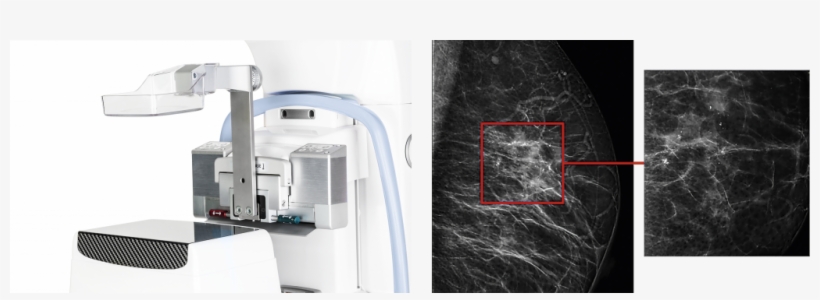 Artemis' Sterotactic Biopsy System Guides You Through - Floor, transparent png