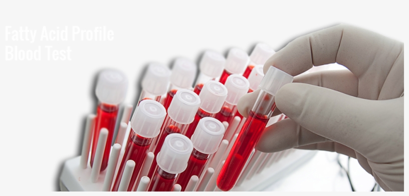 Keep Fat Related Health Problems In Check - Blood Test Tubes Png, transparent png