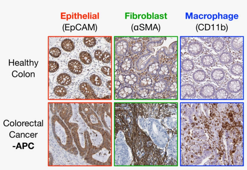 Figure 1 - Igneous Rock, transparent png