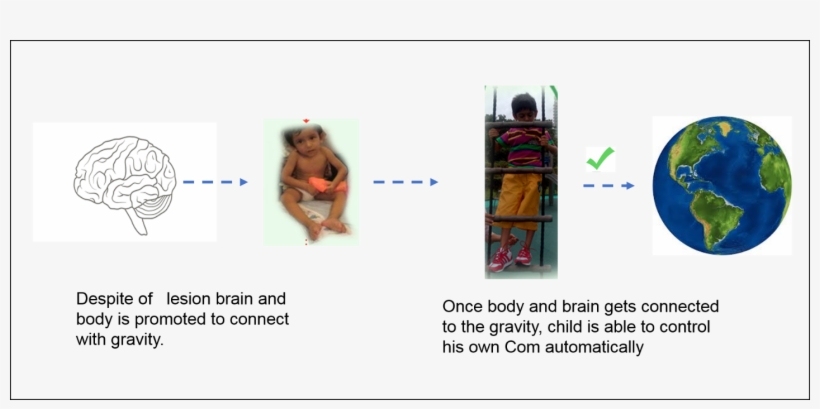 Vasa Concpets Helps Child With Brain Lesion To Connect - Online Advertising, transparent png