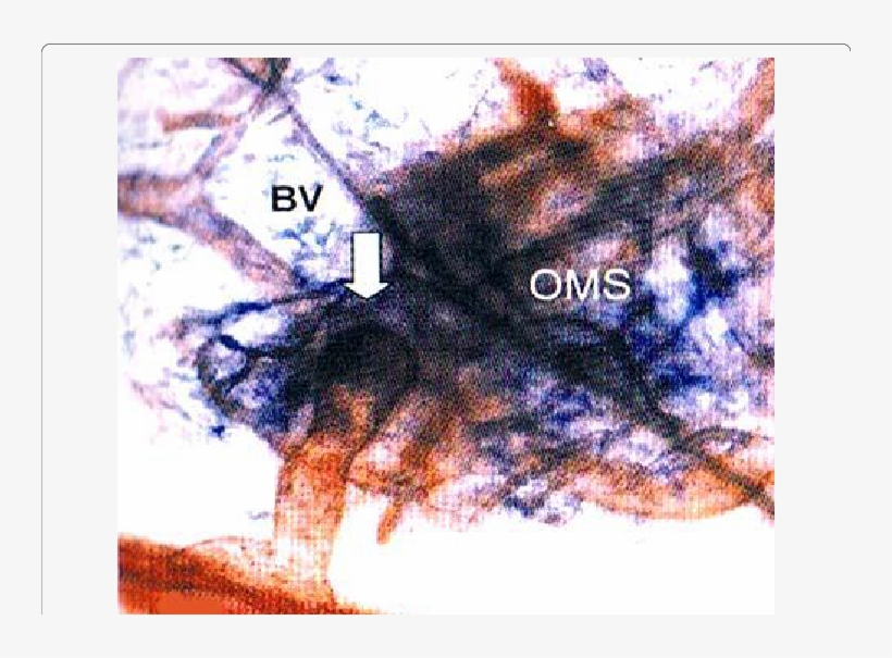 Enzyme Histochemical Staining Of Blood And Lymphatic - Blood Vessel, transparent png