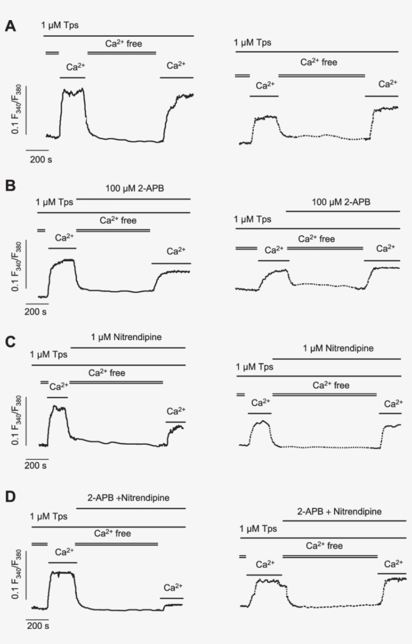 Capacitative Ca 2 Entry Is Impaired In Gallbladder - Diagram, transparent png
