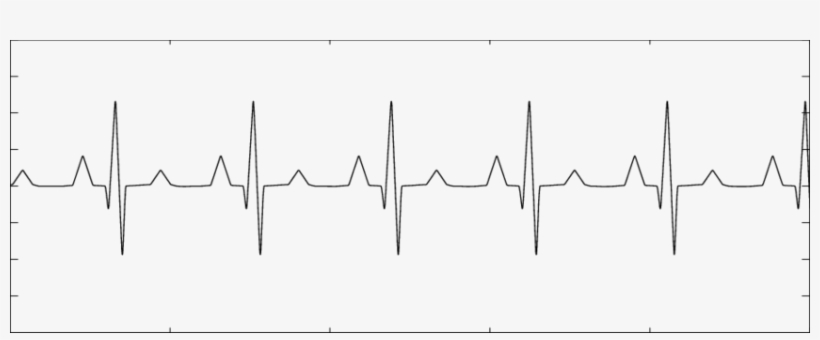 Maternal Heartbeat Signal - Plot, transparent png
