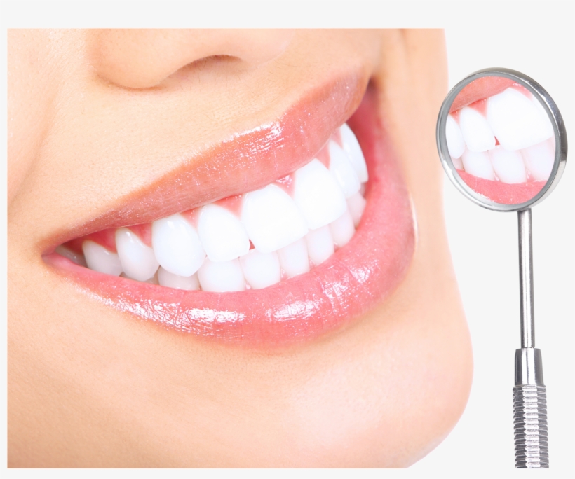 Should I Be Whitening My Teeth - White Teeth Dental Services, transparent png