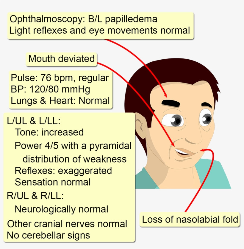 Another Headache - Cartoon, transparent png
