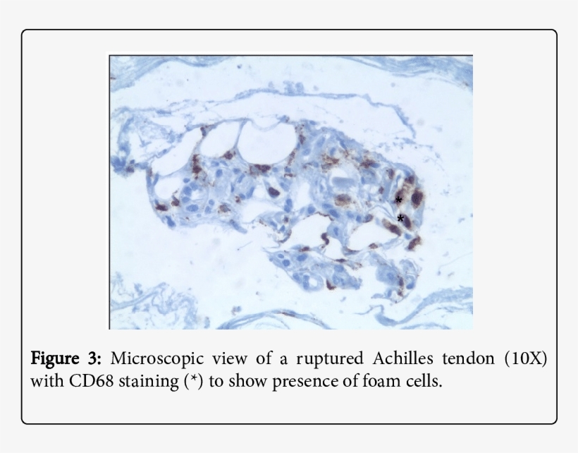 Shows The Results Of The Laboratory Tests - Snow, transparent png