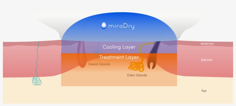 Finally, Thermal Energy Is Delivered And The Sweat - Graphic Design, transparent png