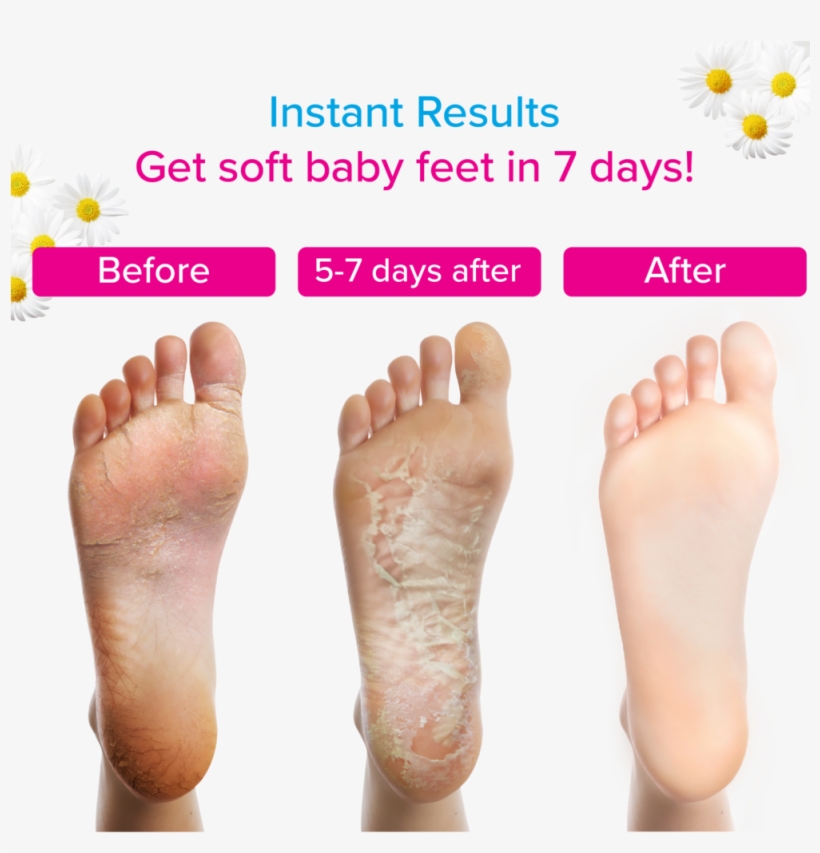 Daiwa Felicity Dream Feet Exfoliating Foot Peel Mask Foot Peel Mask