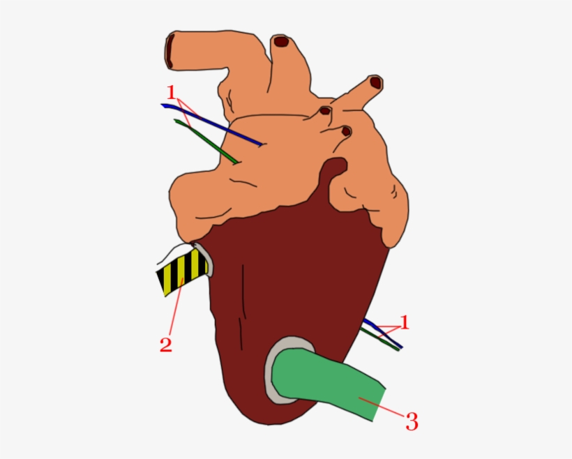 394px-coeur Auxiliaire - Secondary Heart Space Marine, transparent png