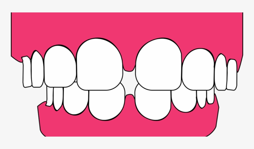 Clip Art Black And White Jasper Ave Dental Tips To - Teeth Graphic, transparent png
