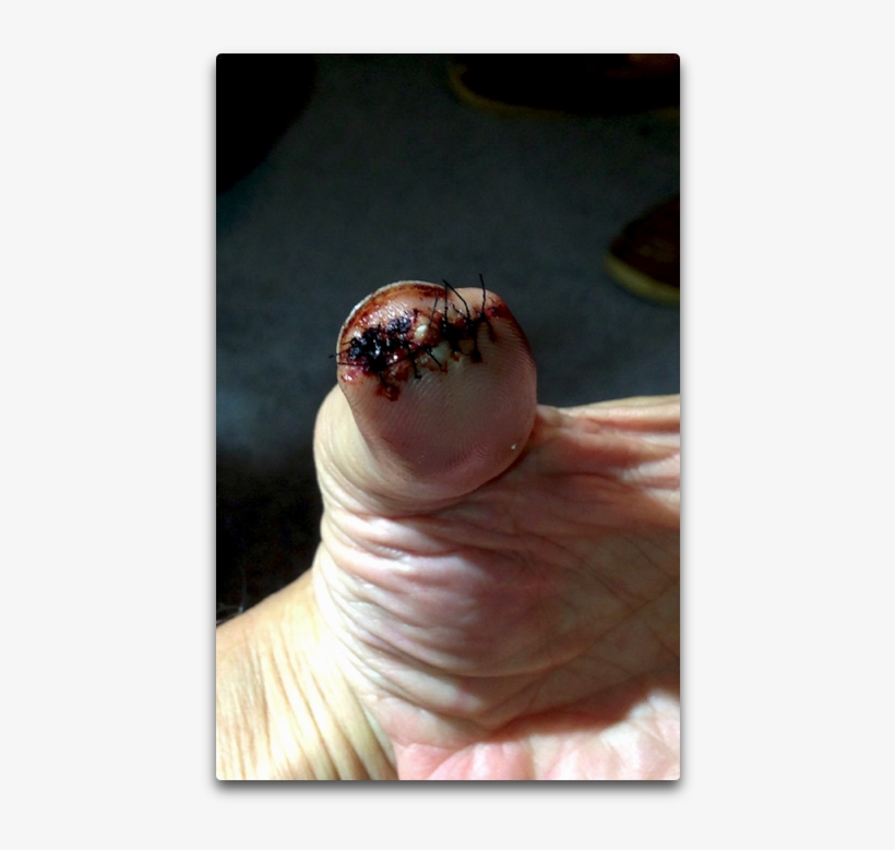 Bad Thumb - Insect, transparent png