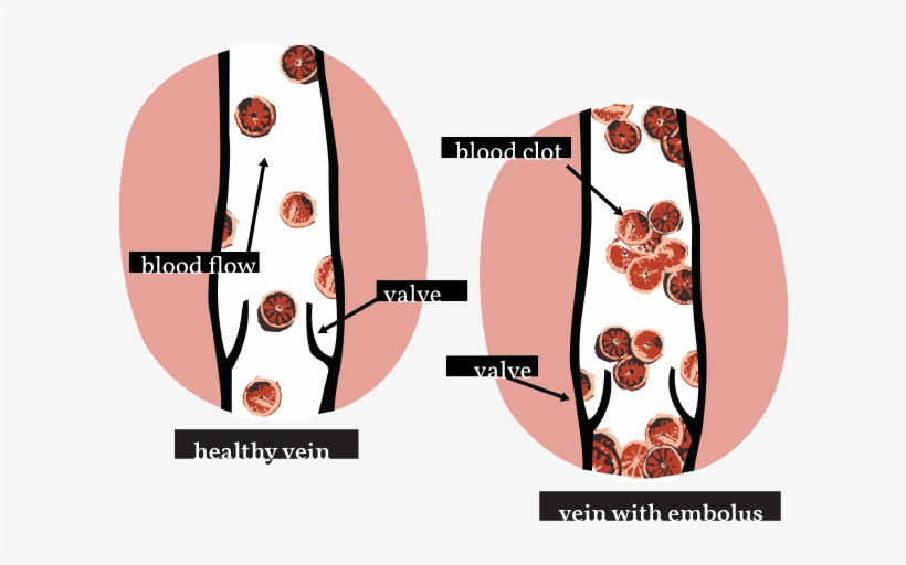 Dvt Web Full - Circle, transparent png