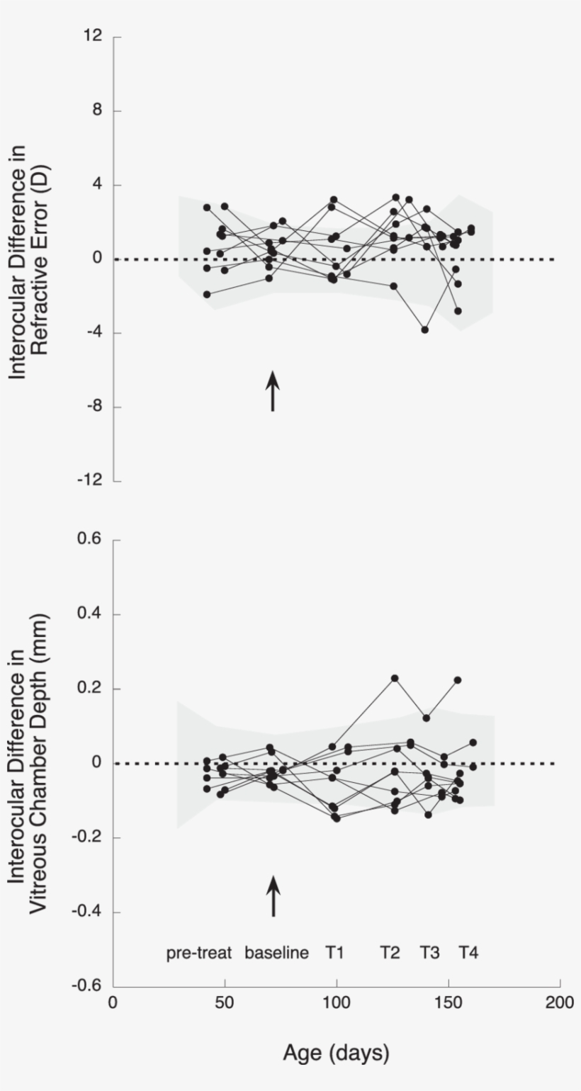 Interocular Differences At Pretreatment - Diagram, transparent png
