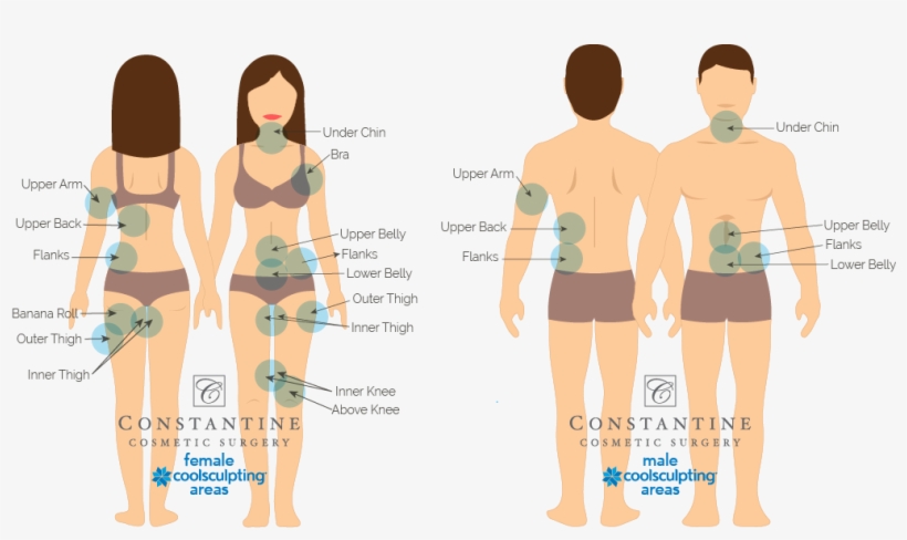 No Matter Which Area You May Be Considering For Coolsculpting, - Cartoon, transparent png