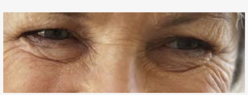For Fine Lines, Deep Wrinkles, Improvement In Texture - Close-up, transparent png