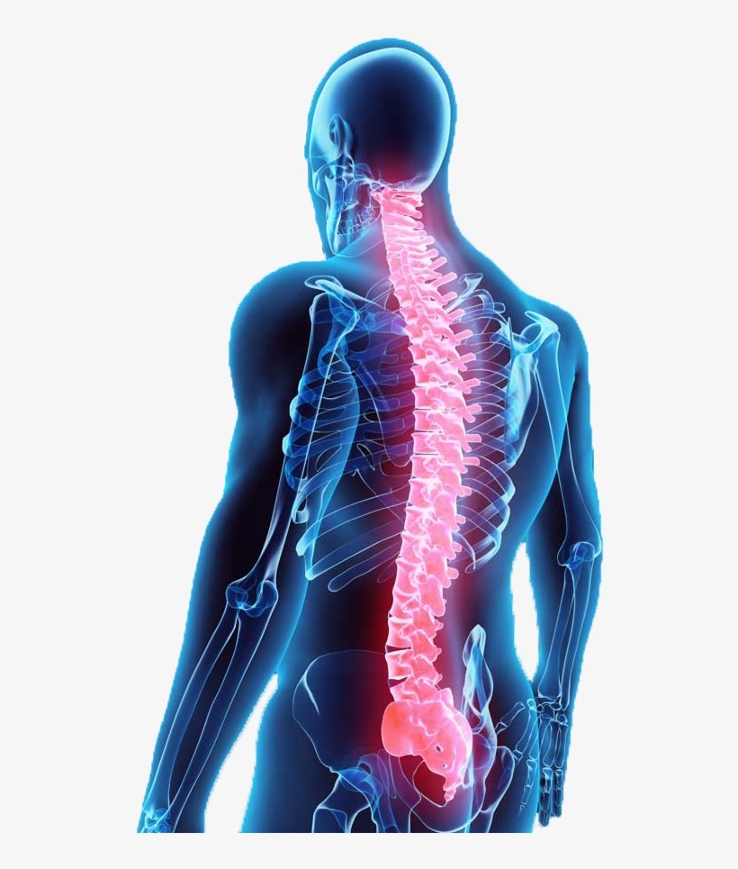 Illustration Of Back With Spine Shown In Red - Spine Surgery Cost Banner, transparent png