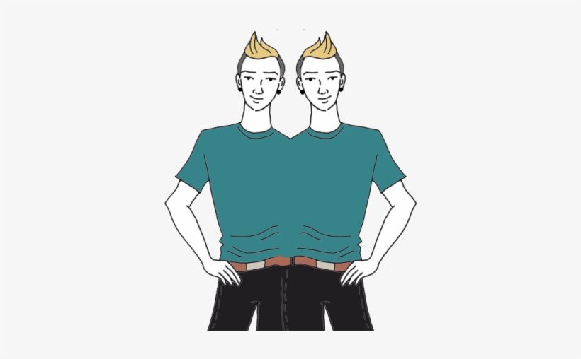 Siamese Twins - Conjoined Twins, transparent png