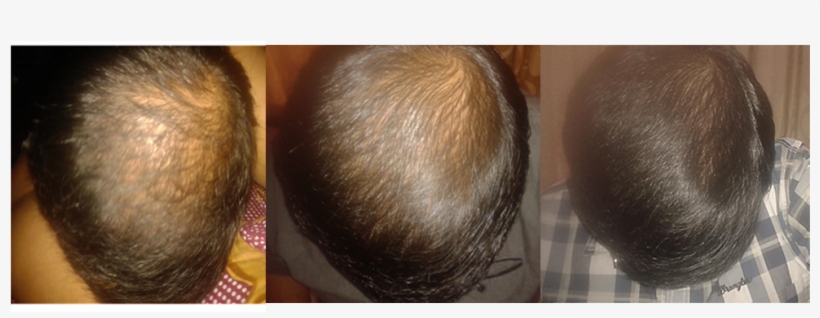Dermatologist In Chennai, transparent png