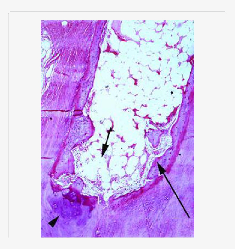 Higher Magnification Of Figure 1 Showing The Spongy - Creative Arts, transparent png