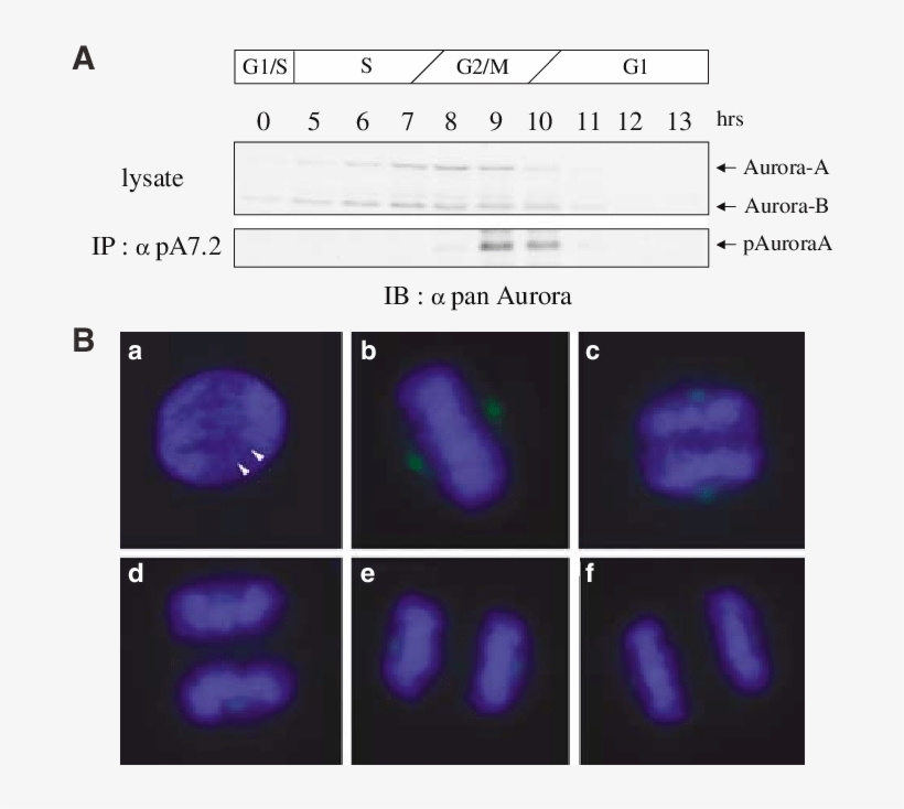 Restricted Thr288 Phosphorylation Of Human Aurora-a - Thymidine, transparent png