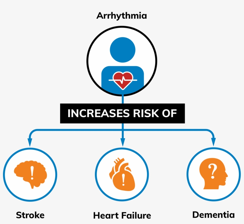 Irregular Heart Rhythms Increase Your Risk Of Stroke - Diagram, transparent png