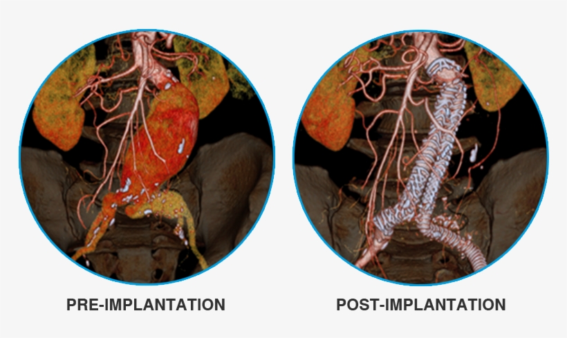 3d Reconstruction Images Courtesy Of Dr - Freshwater Crab, transparent png