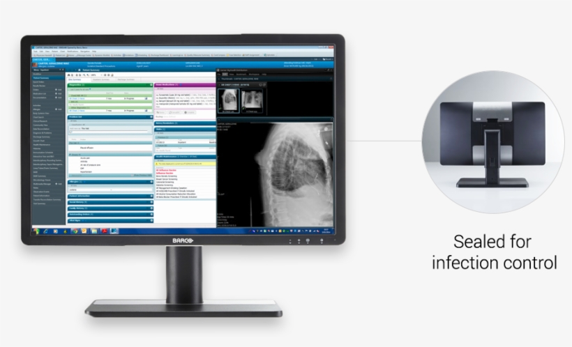 Book A Demo - Barco Mdrc 2224 Bl, transparent png