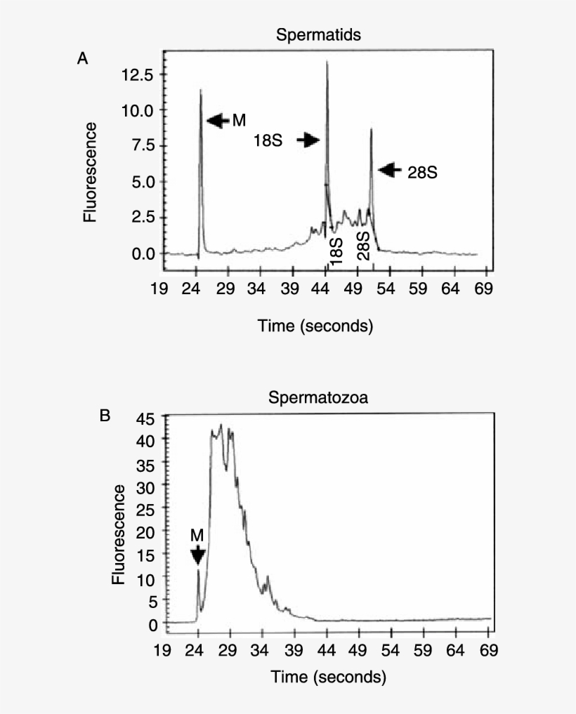 Total Rna Microelectrophoretic Profiles Of Spermatids - Diagram, transparent png