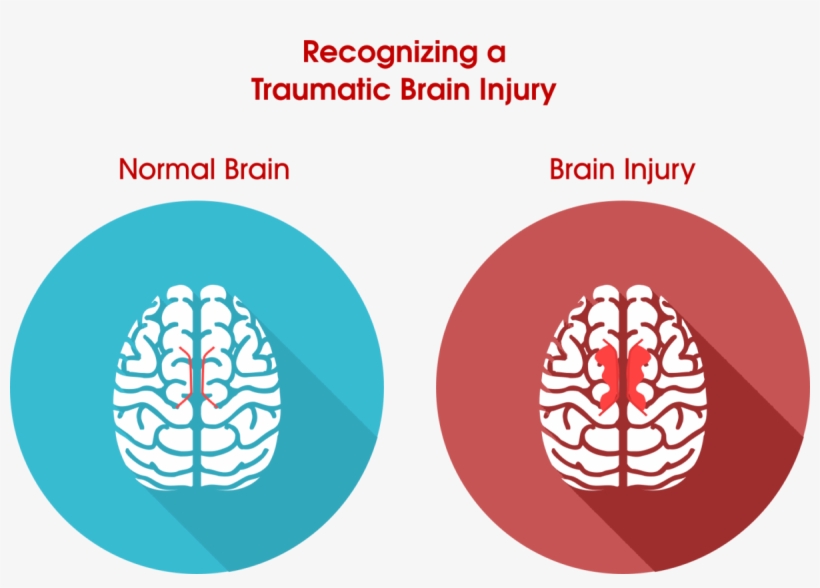 Imagine You've Got An Extremely Big And Elaborate Jigsaw - Normal Brain Vs Injured Brain, transparent png