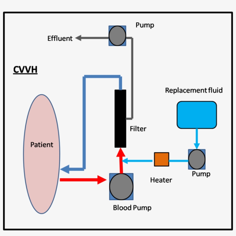 Acute Kidney Injury Requiring Renal Replacement Therapy, - Diagram, transparent png