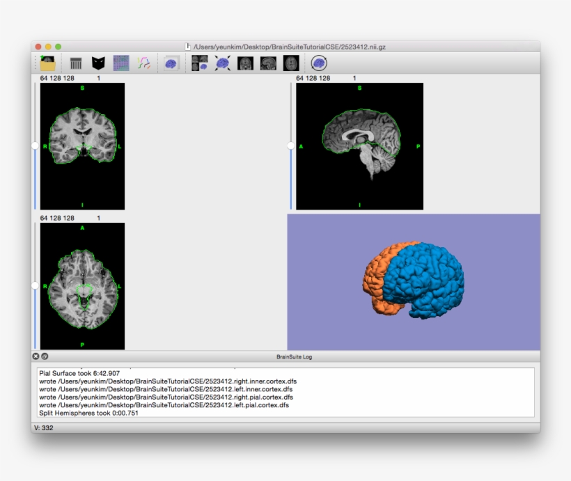 Final Output Of Cse, With Cross-hairs Off And Volume - Circle, transparent png