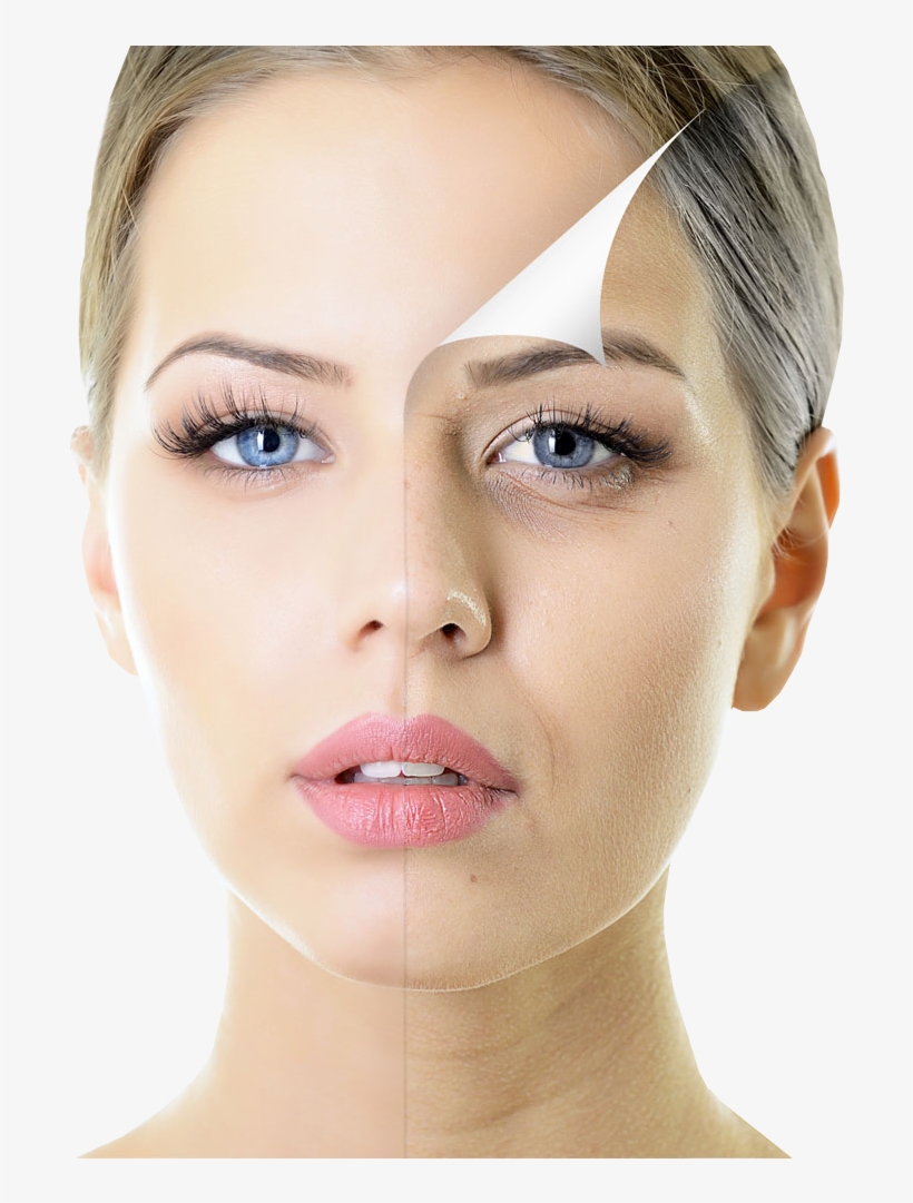 Beautiful Woman With Half Face Spotty Skin, transparent png